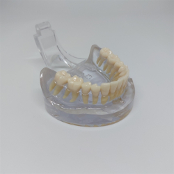 Transparent Kbemodel med Tnder 